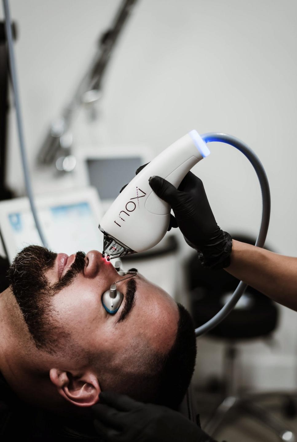 Microneedling & Lasers
